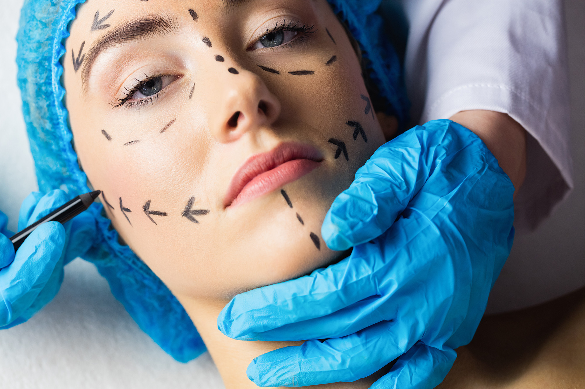 Things To Consider Before Going For A Plastic Surgery